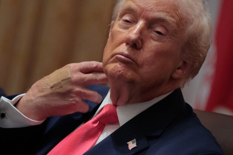 Donald Trump's health under scrutiny