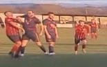 footballer elbow incident photo