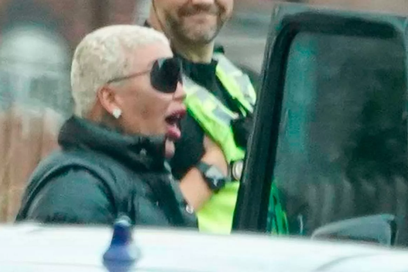 A photograph of The Lip King, a reality TV star who died after being arrested in connection with the death of a woman who underwent a butt lift procedure, with a focus on the risks associated with cosmetic surgery and the influence of celebrity culture