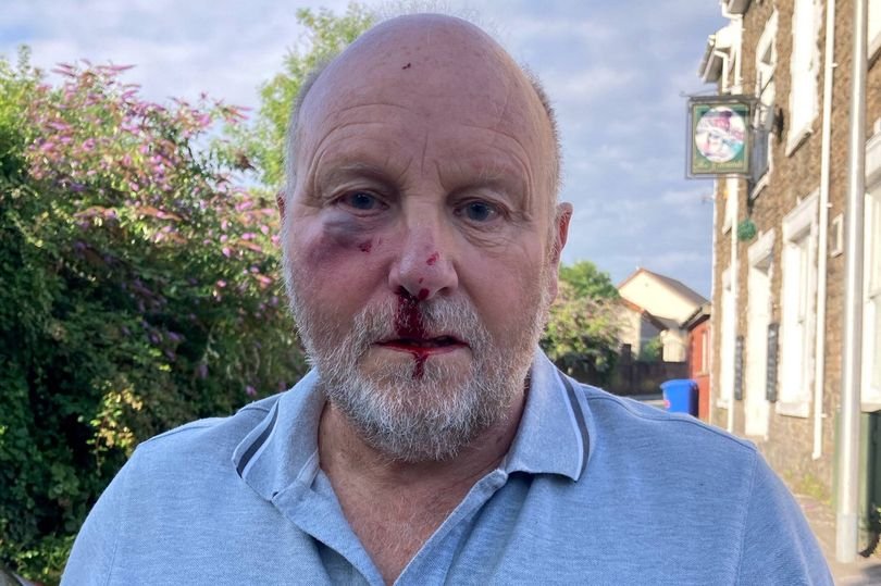 A pensioner was battered for obeying the 20mph speed limit, sparking a wider debate about road safety and the measures that can be taken to prevent such incidents from occurring in the future, with a focus on road rage and aggressive driving behaviour