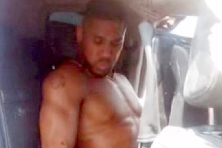Anthony Joshua injured in Nigeria car crash
