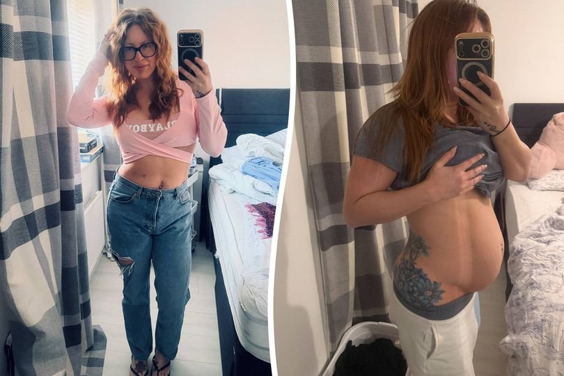 A mother who has been waiting 24 years for a diagnosis of a rare condition that makes her appear pregnant, highlighting the importance of self-advocacy and perseverance in the face of adversity, with a focus on abdominal distension