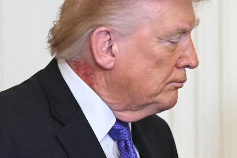 Donald Trump at a public event, smiling and waving to the crowd, with a focus on his weight and health