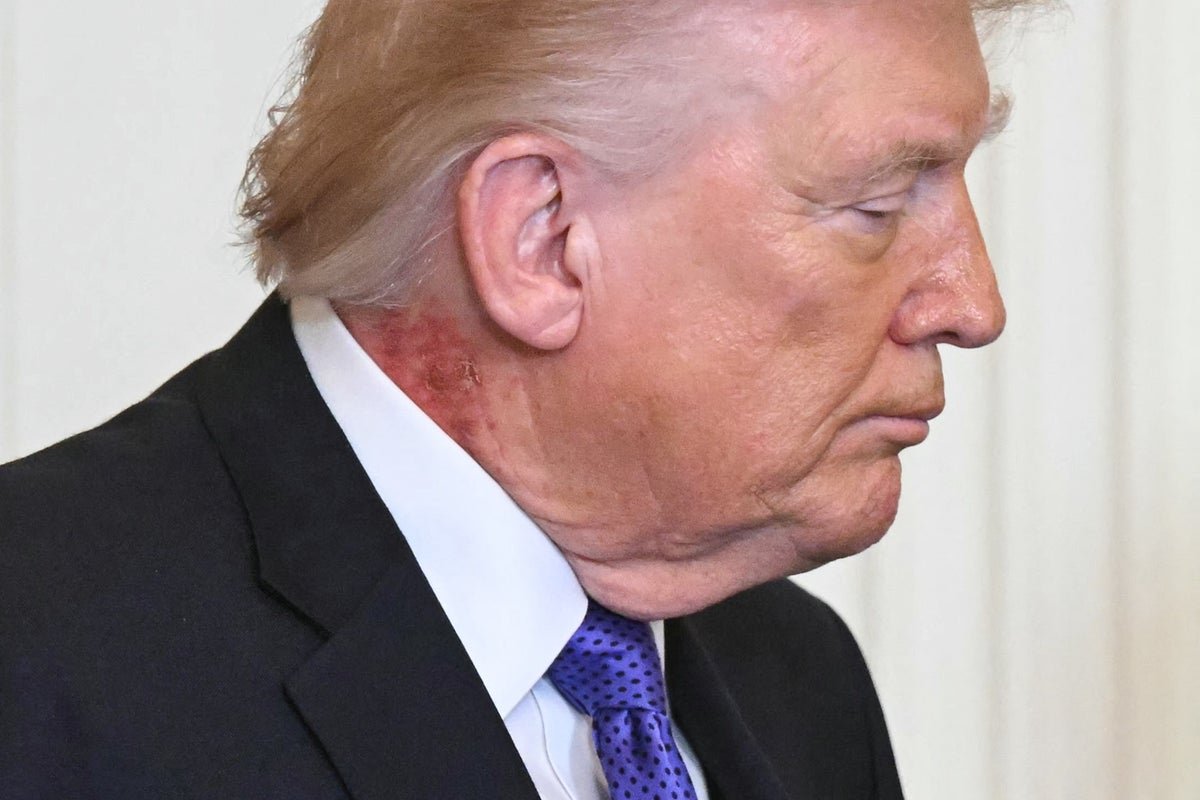 Donald Trump at a public event, smiling and waving to the crowd, with a focus on his weight and health